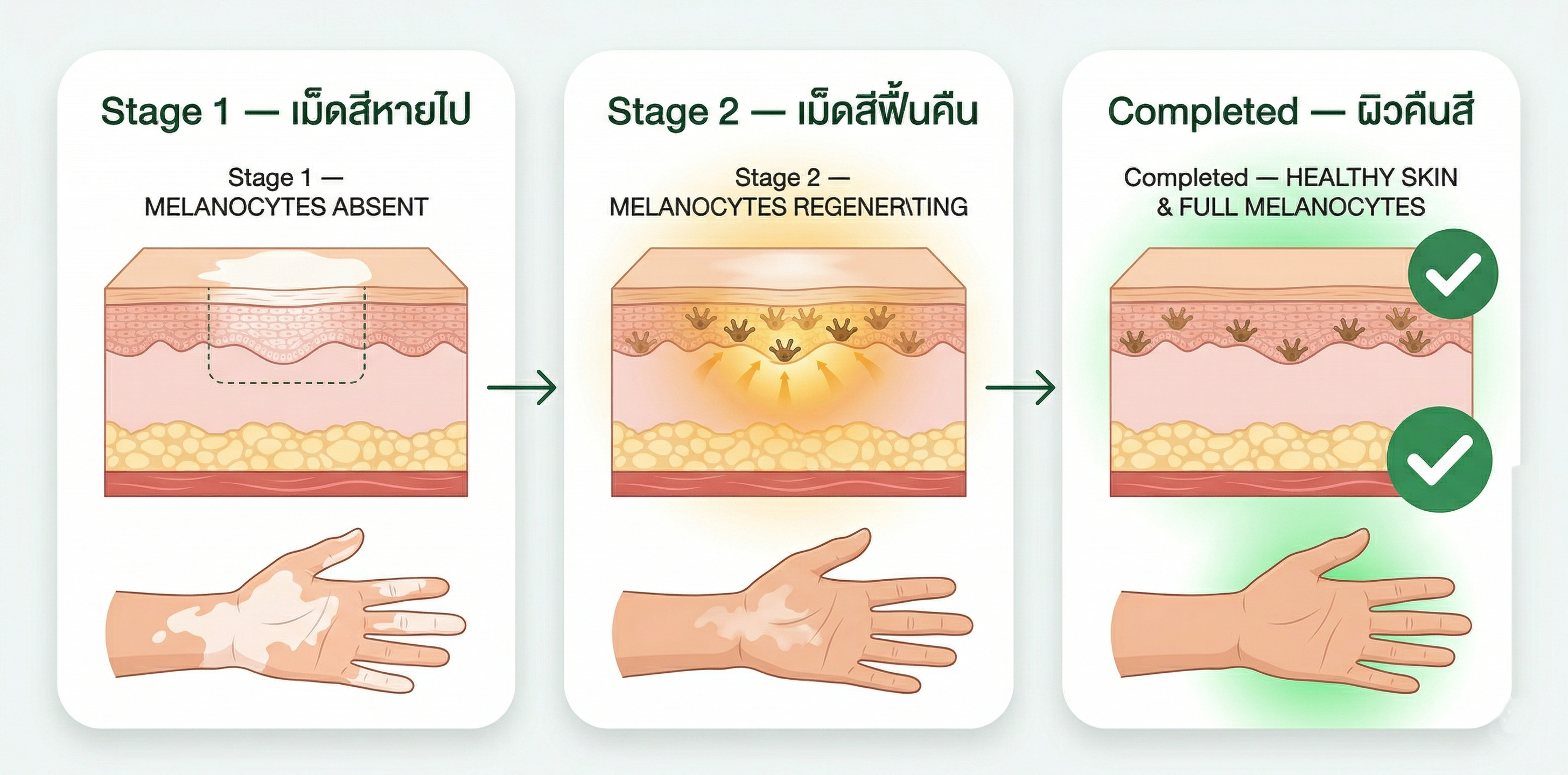 ขั้นตอนรักษาด่างขาว