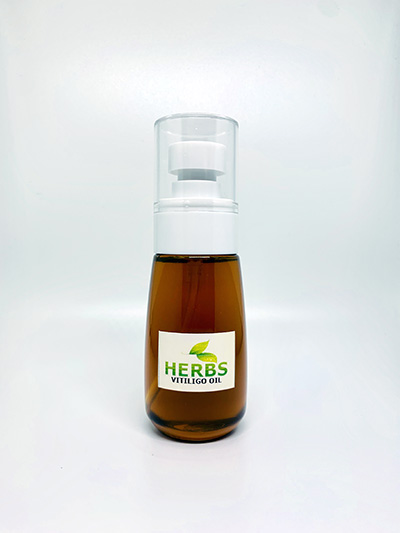 ยาทาด่างขาว 30ml